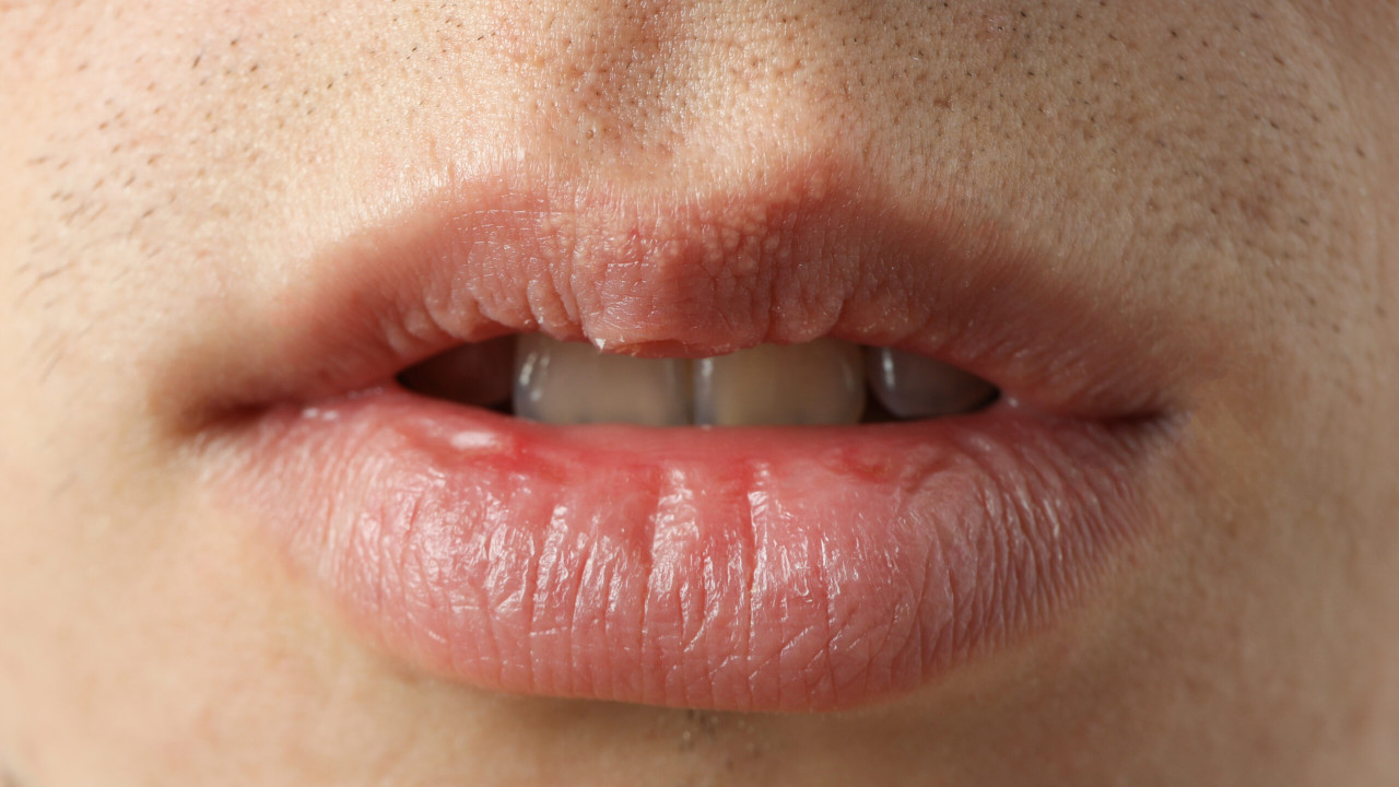 Suche usta: sprawdź, jak dbać o nie latem!