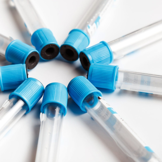 Badanie APTT - opis, zalecenia i przebiega badania