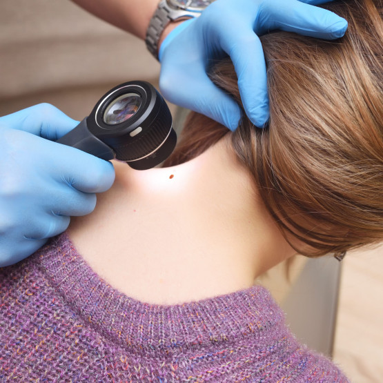 Dermatoskopia – opis i przebieg badania