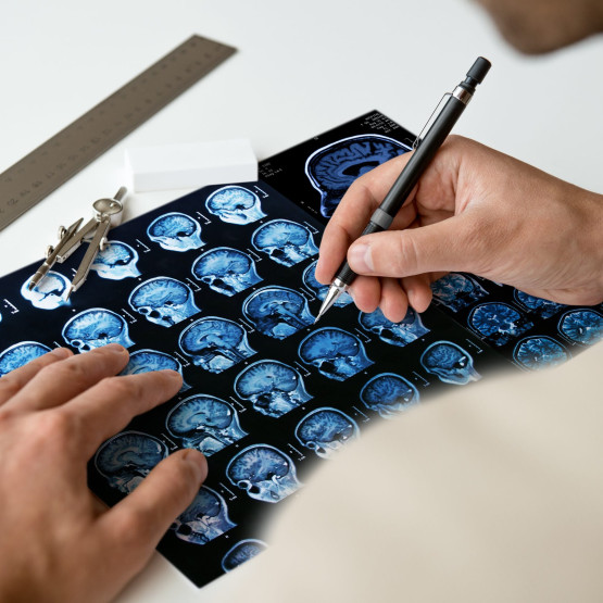 Tecfidera 120 mg - dzień drugi terapii [BLOG]