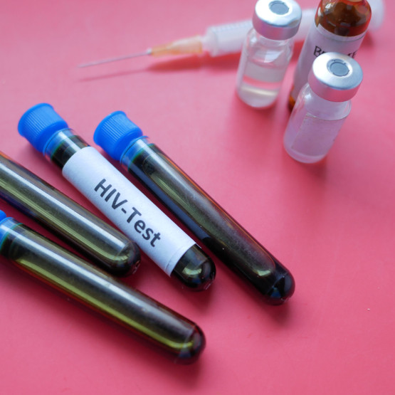 AIDS – diagnoza, przebieg i leczenie choroby