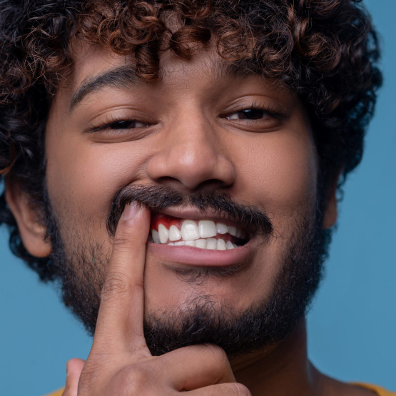 Krwawiące dziąsła