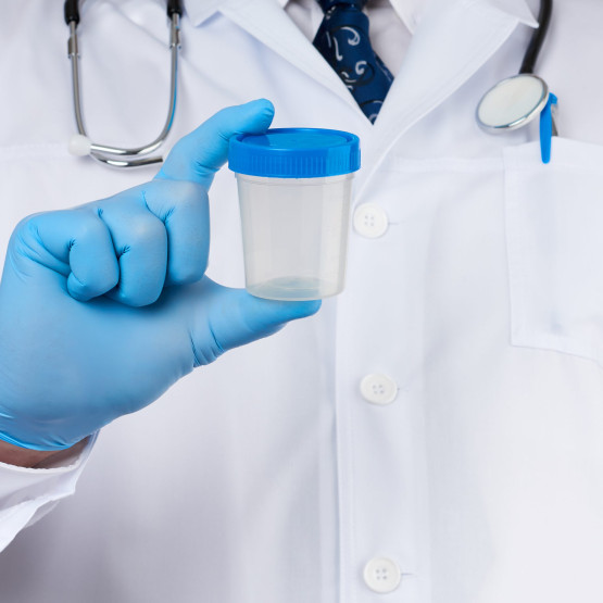 Analiza moczu - opis i wskazania wykonania badania